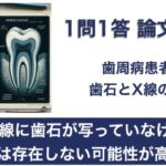 Q. X線に歯石が写っていなければ歯石は存在しない可能性が高い？【1問1答 論文解説】